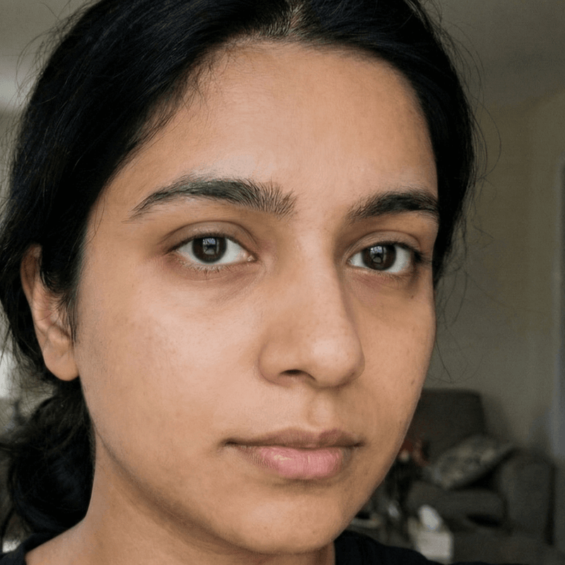 After Dark Spots Faded 70%