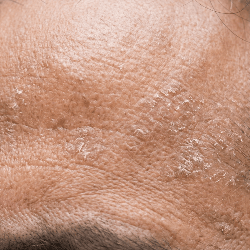 Before Texture improved