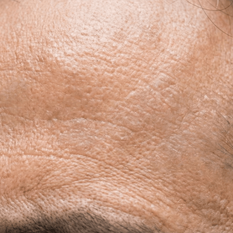 After Texture improved