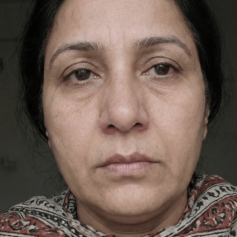 Before Radiance boosted